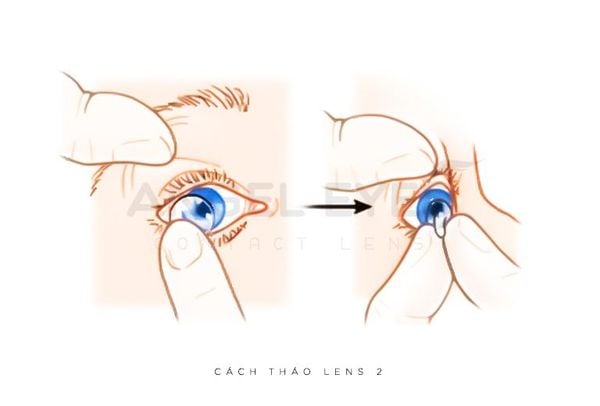 cach-thao-lens