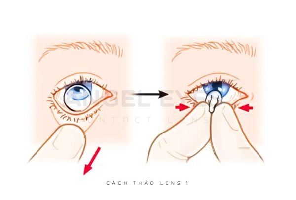 cach-thao-lens