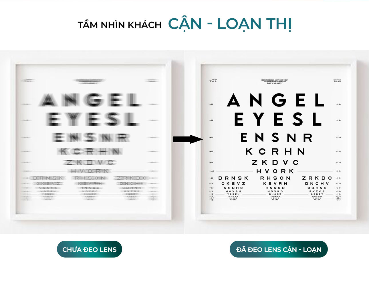 KÍNH ÁP TRÒNG LOẠN THỊ TRONG SUỐT SỬ DỤNG 24/24 CAO CẤP TỪ HÀN QUỐC